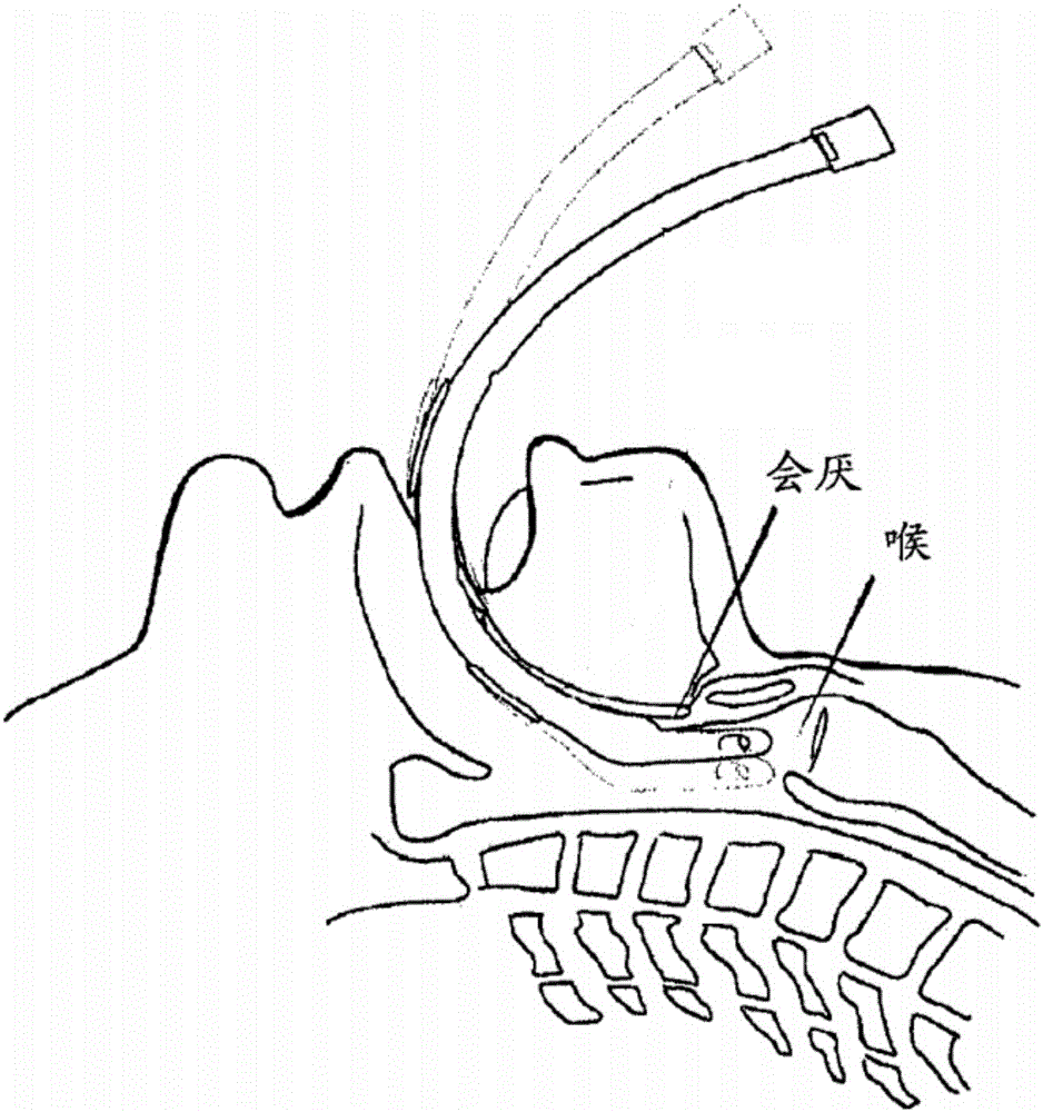 Visual laryngoscope