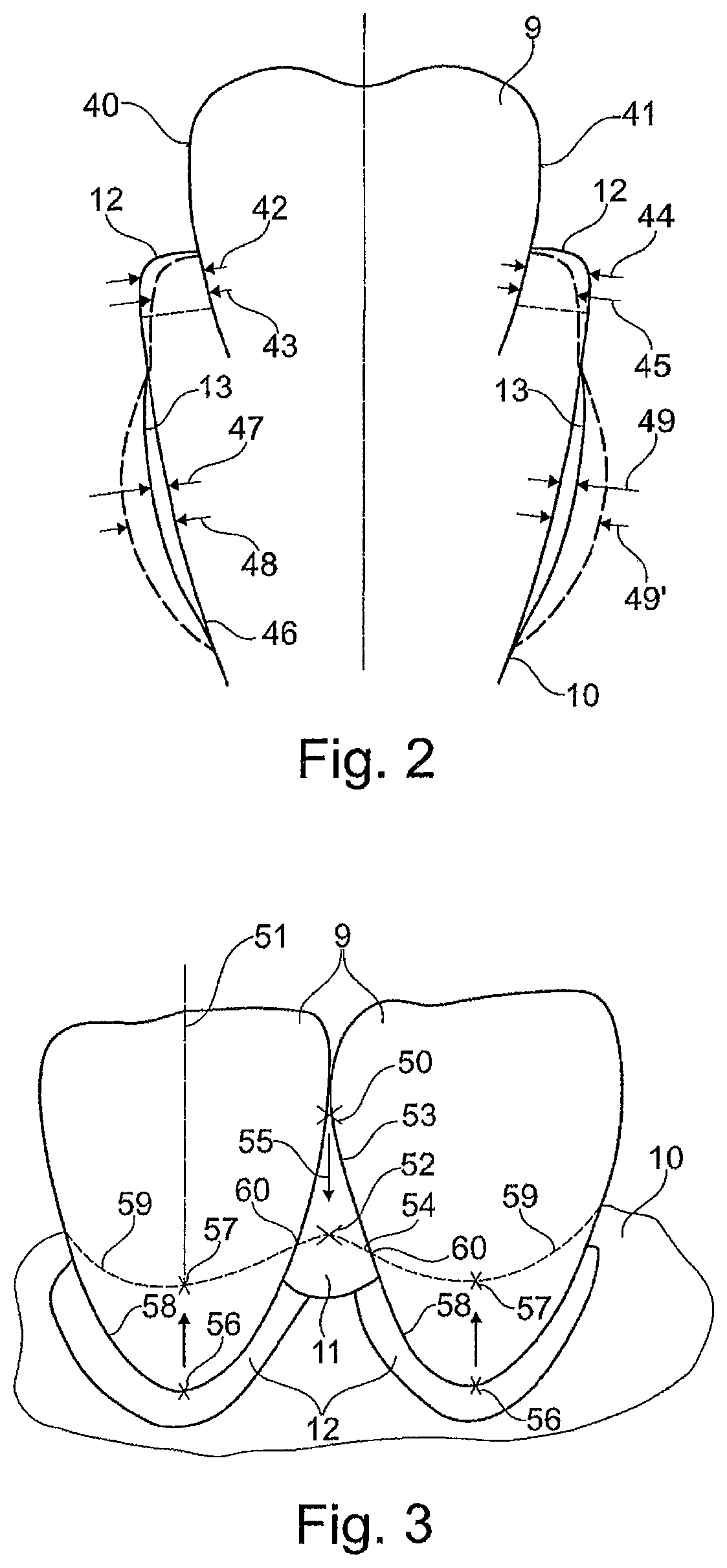 Method for the virtual secondary machining of a gingiva model
