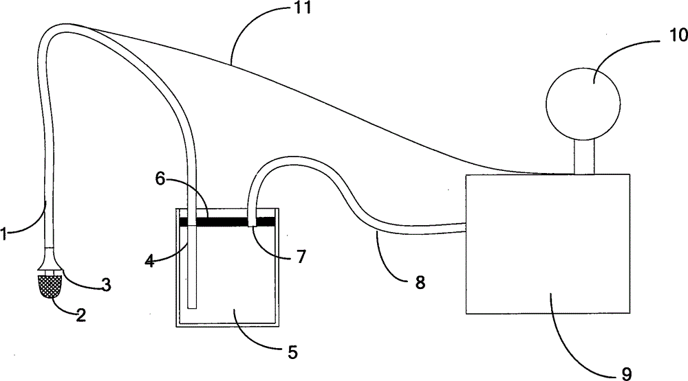 Novel gastrointestinal decompression device