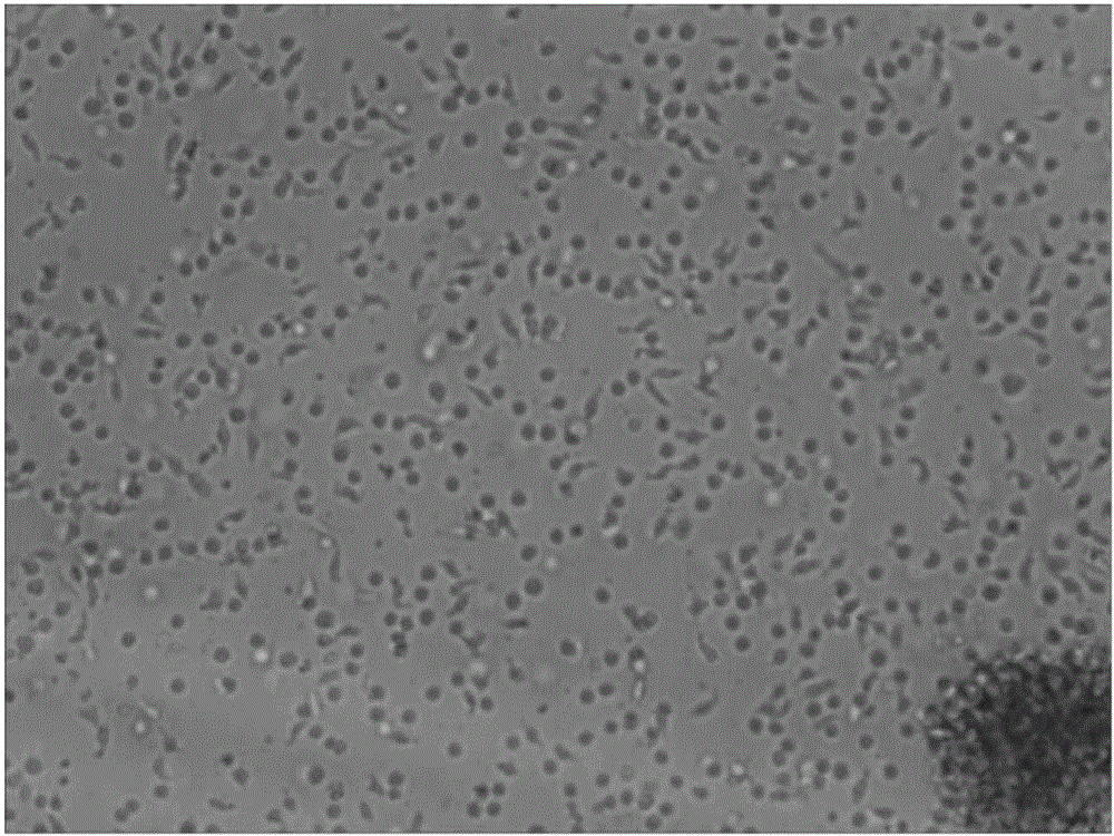 Preparation method and application of CIK (Cytokine-induced Killer) modified by anti-human CD19 chimeric antigen receptor