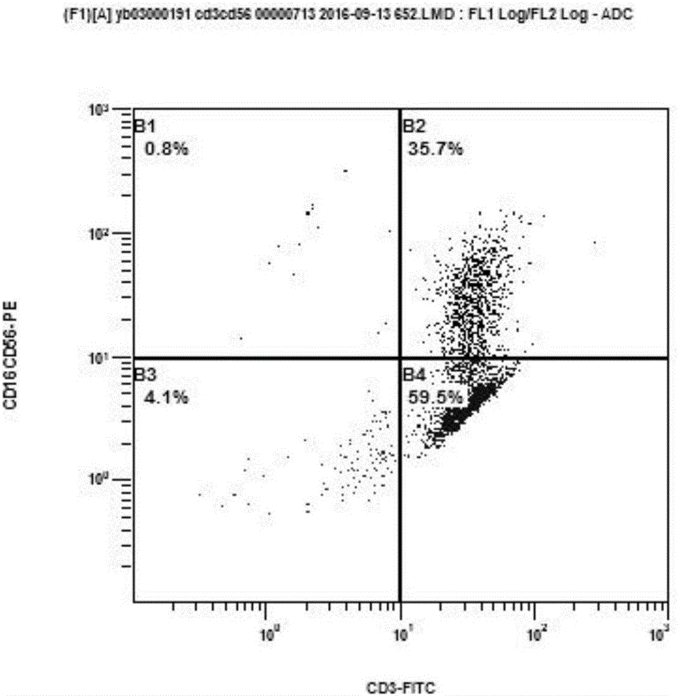 Preparation method and application of CIK (Cytokine-induced Killer) modified by anti-human CD19 chimeric antigen receptor