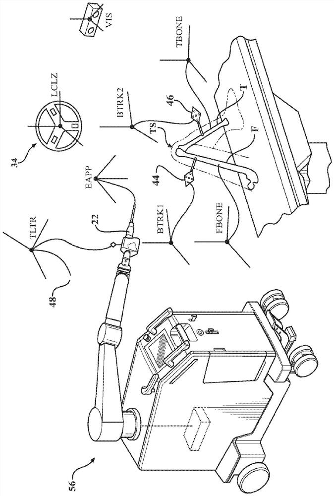 Systems and methods for performing surgery on a patient at a target site defined by virtual objects