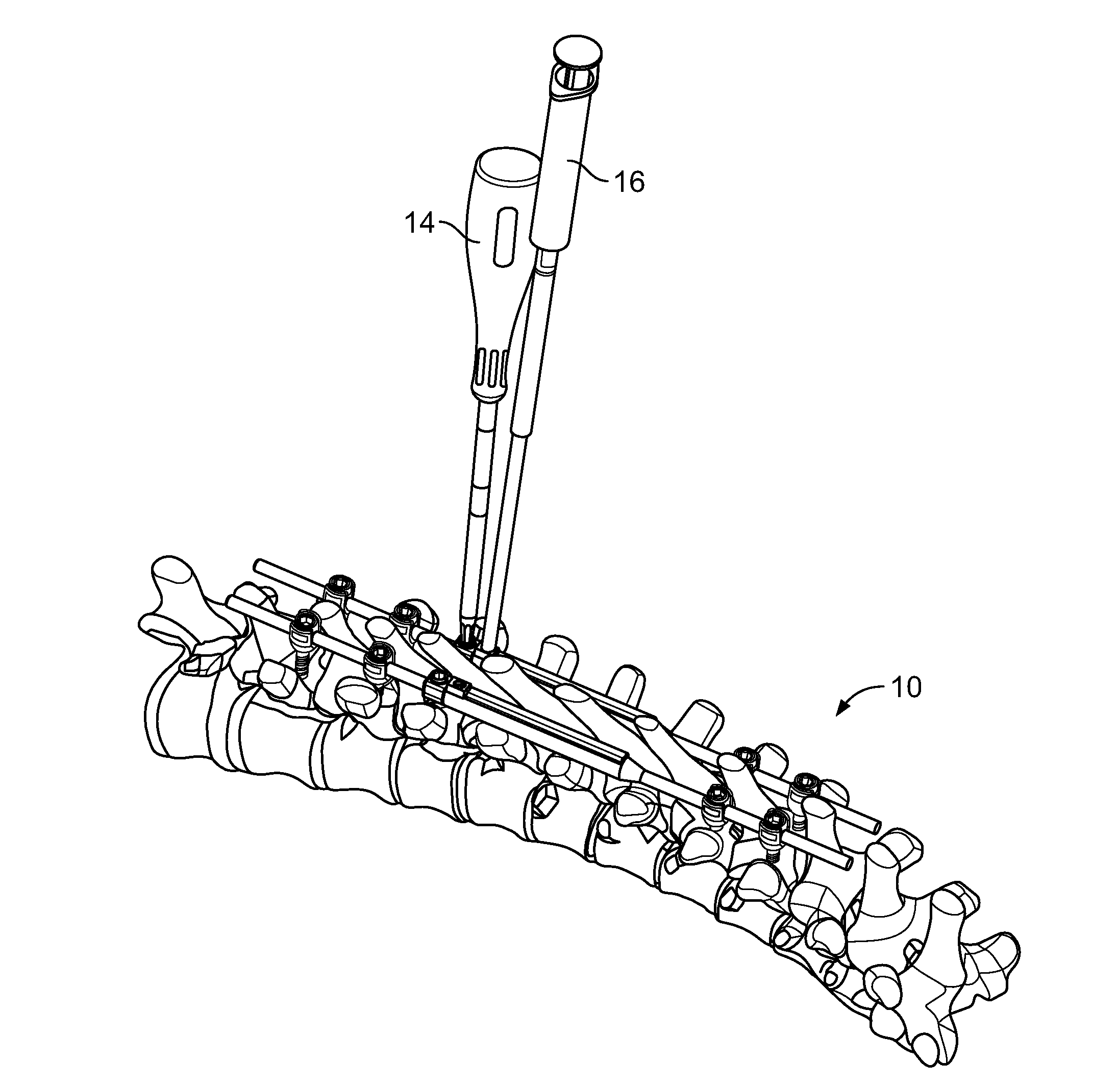 Growing rods and methods of use