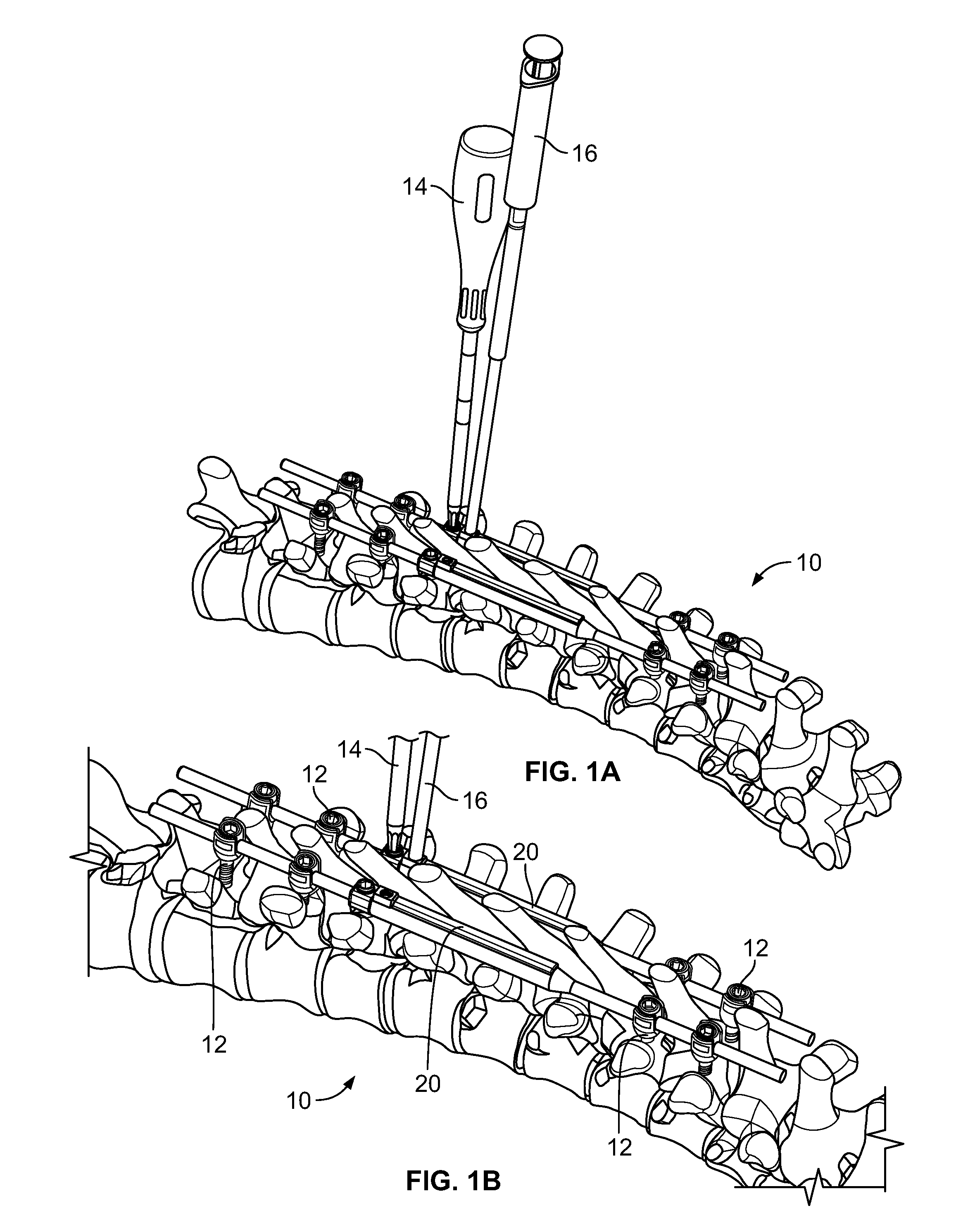 Growing rods and methods of use