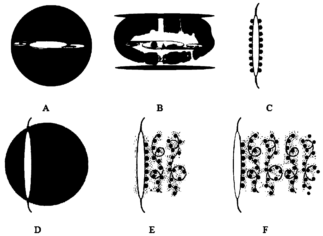 Intraocular lens with divisionally modified rear surface and preparation method of intraocular lens