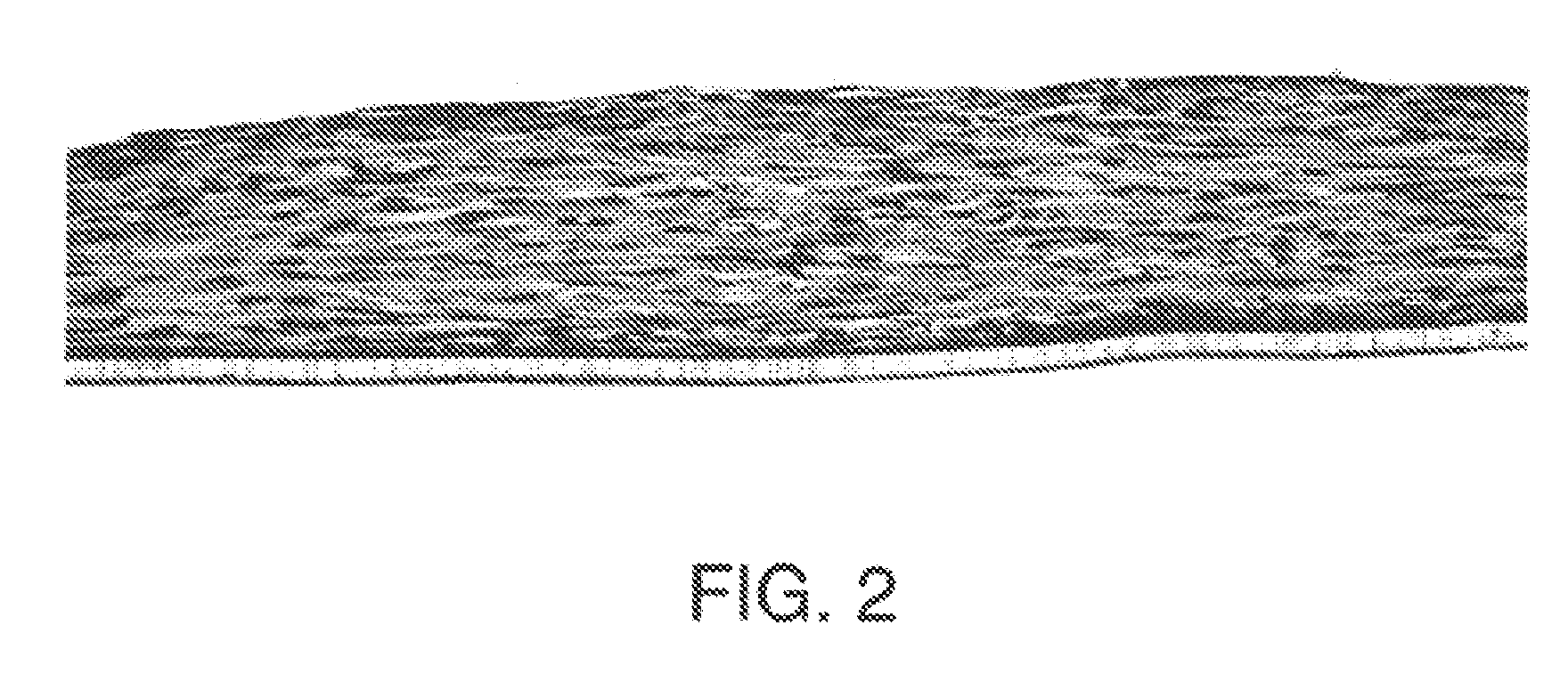 Bioengineered tissue constructs and cardiac uses thereof