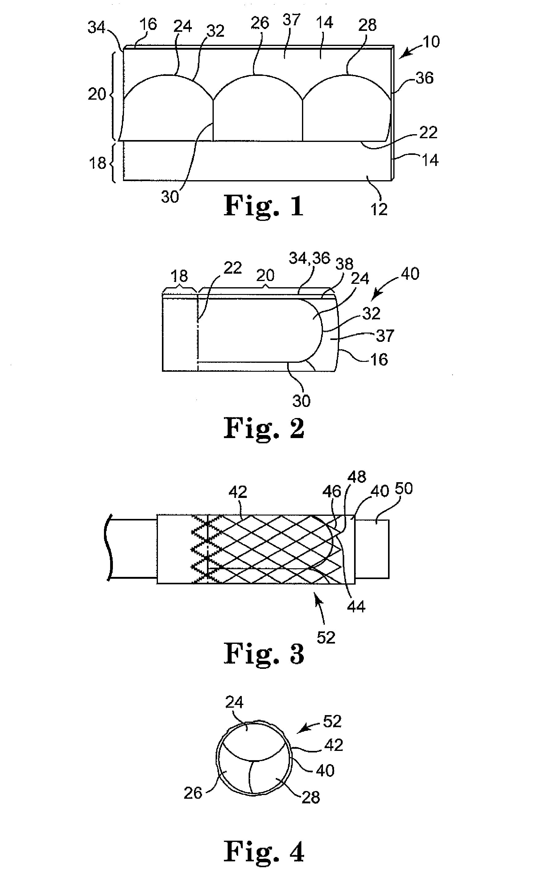 Prosthetic Cardiac Valve from Pericardium Material and Methods of Making Same