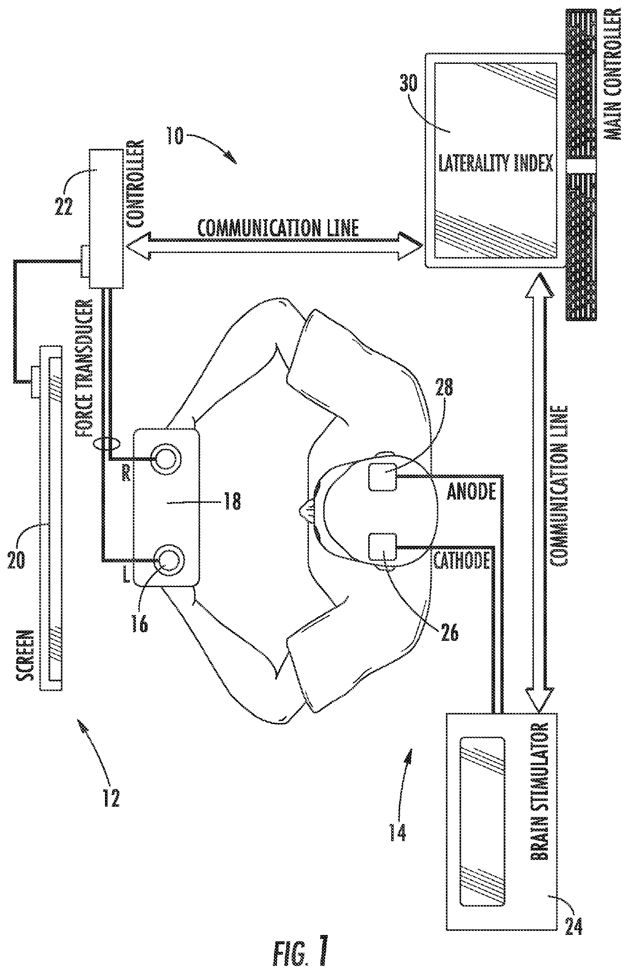 System and method for brain stimulation for improvement of motor symptoms in Parkinson's disease and other movement disorders