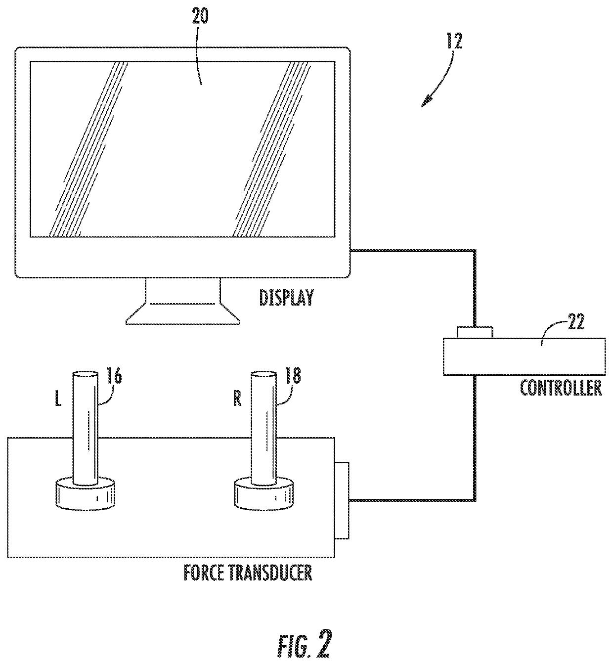 System and method for brain stimulation for improvement of motor symptoms in Parkinson's disease and other movement disorders