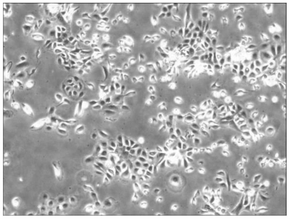 Preparation method and application of a kind of artificial cornea