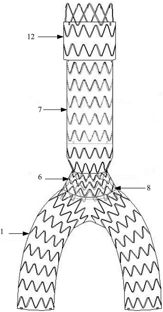 Covered stent and using method thereof