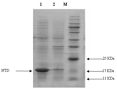 A kind of method utilizing enzyme catalysis to prepare 2'-deoxyadenosine pure product