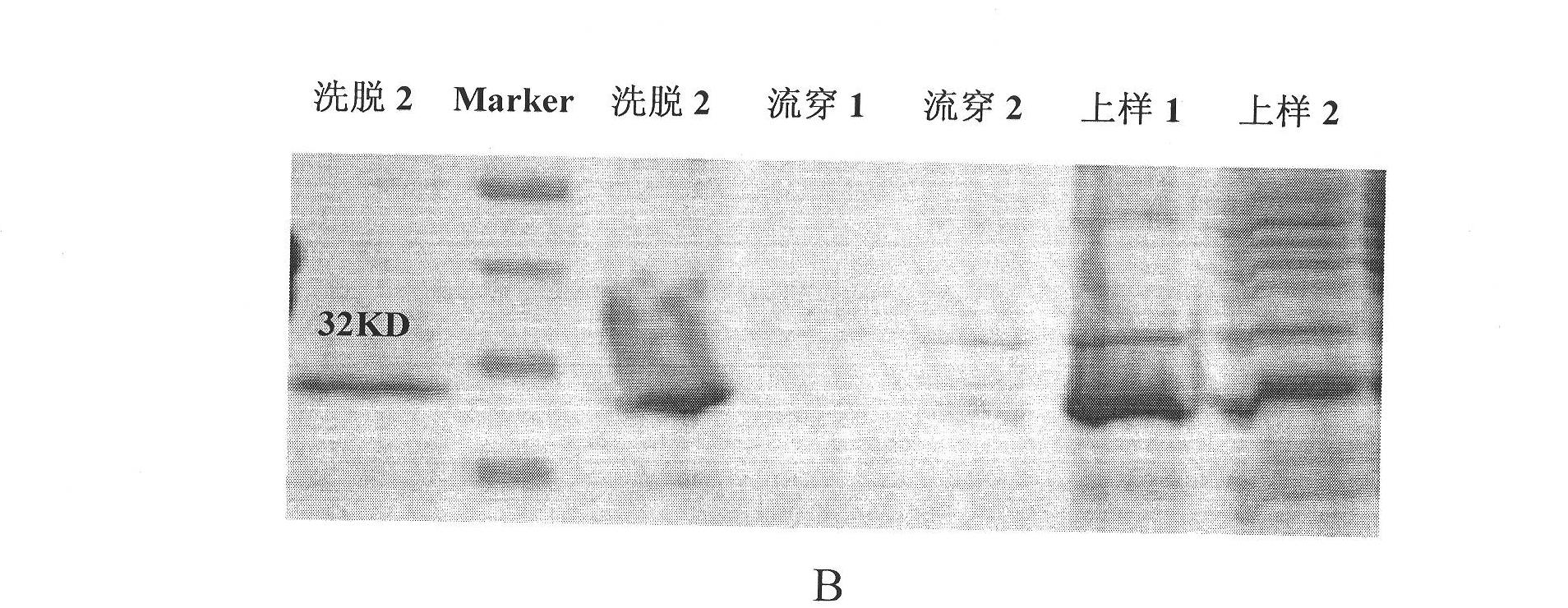 Preparation method and application of mutain of human insulin-like growth factor binding protein 7 (IGFBP7)