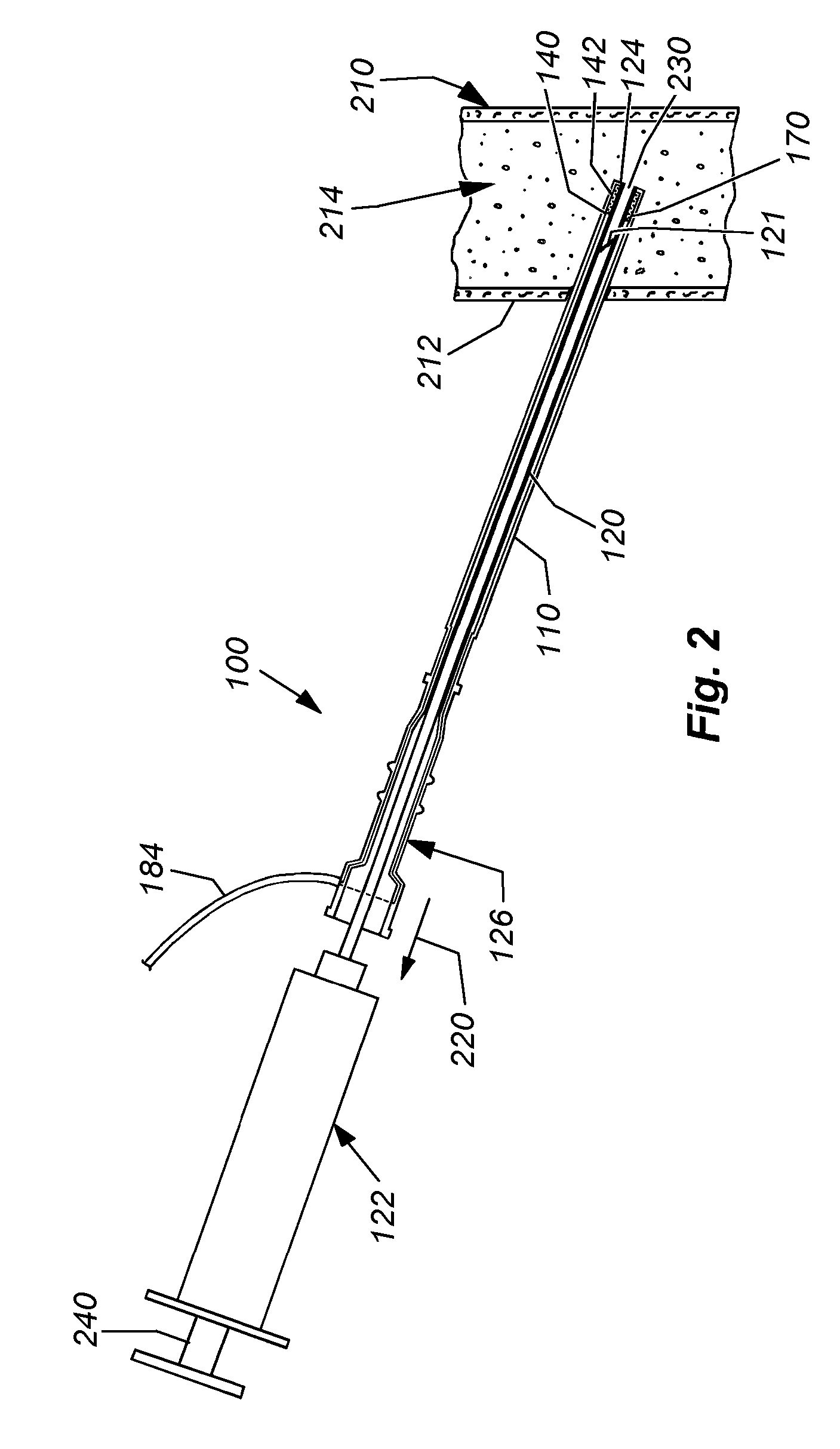 System and method for venous oximetry using a catheter