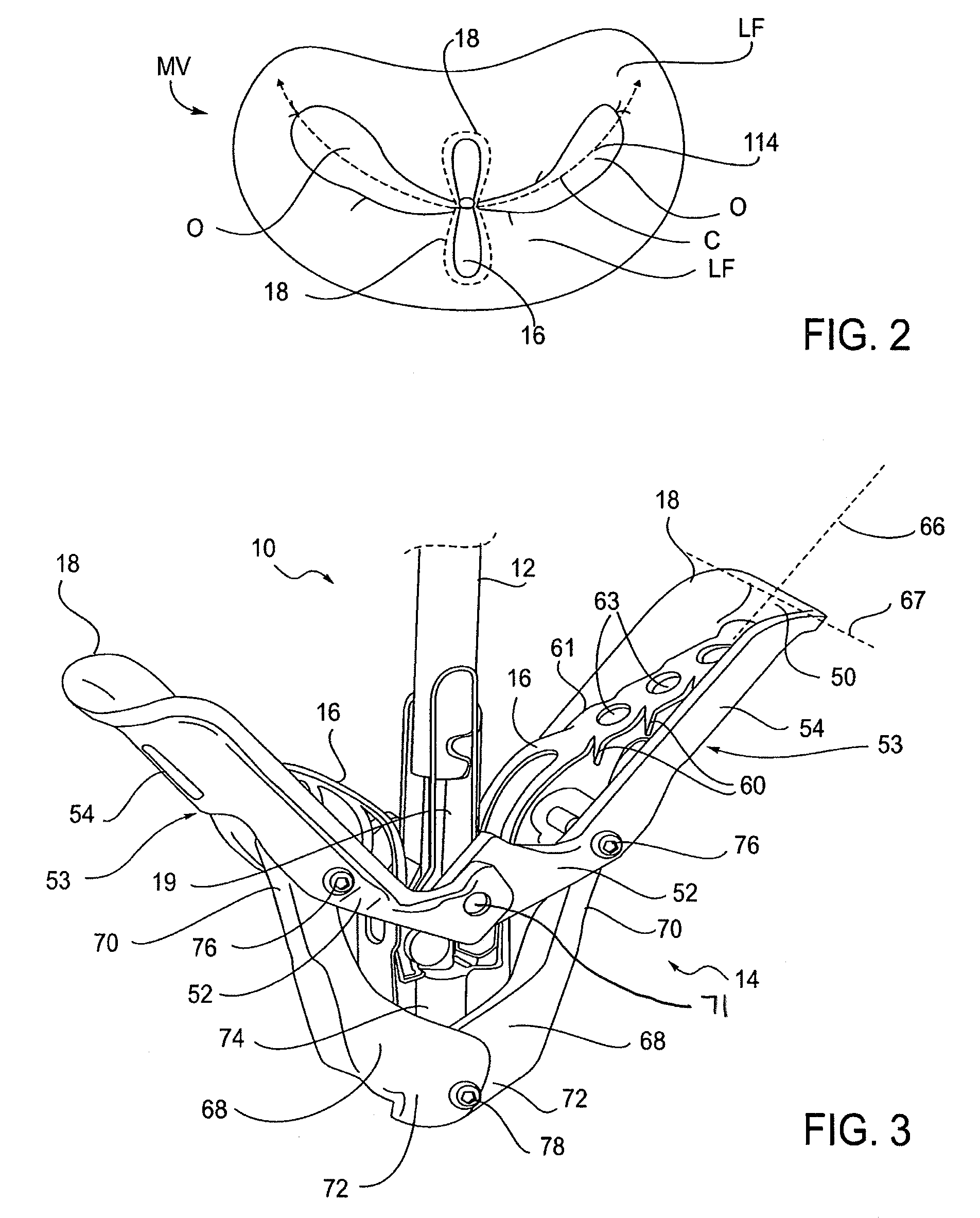 Fixation devices for variation in engagement of tissue
