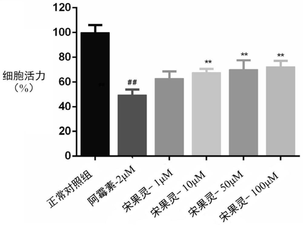 Application of songorine in medicine for resisting doxorubicin cardiotoxicity