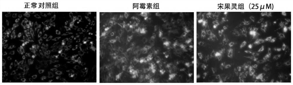 Application of songorine in medicine for resisting doxorubicin cardiotoxicity