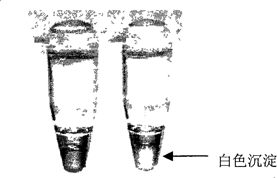Reagent kit and method for detection of enterocolitis yersinia genus with ring mediated isothermality amplification method
