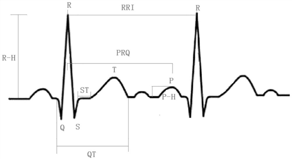 Pre-diabetes detection system and method based on combination of ECG and EEG information