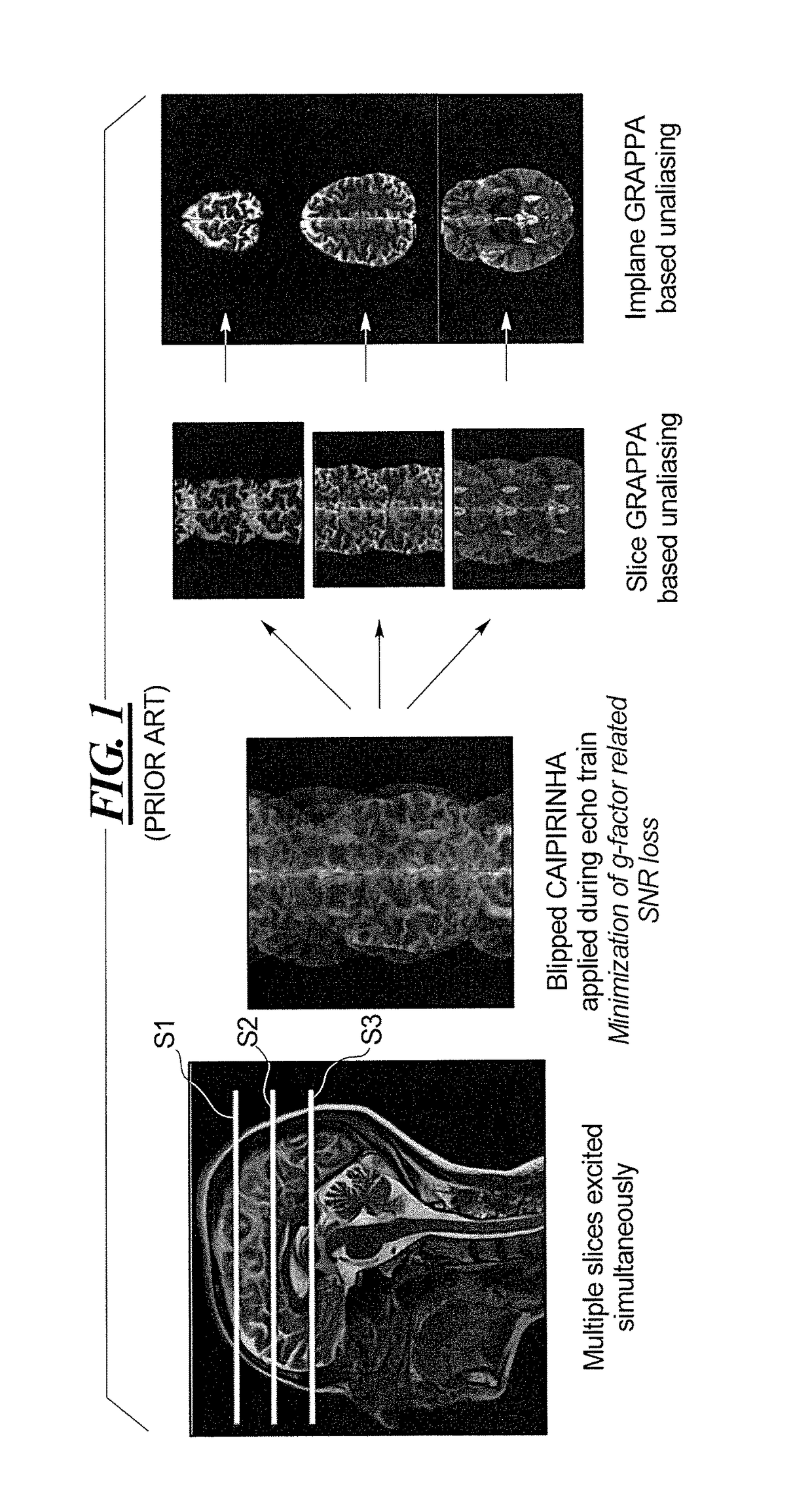Simultaneous multi-slice magnetic resonance imaging with spin excitation using a multi-band radio-frequency pulse
