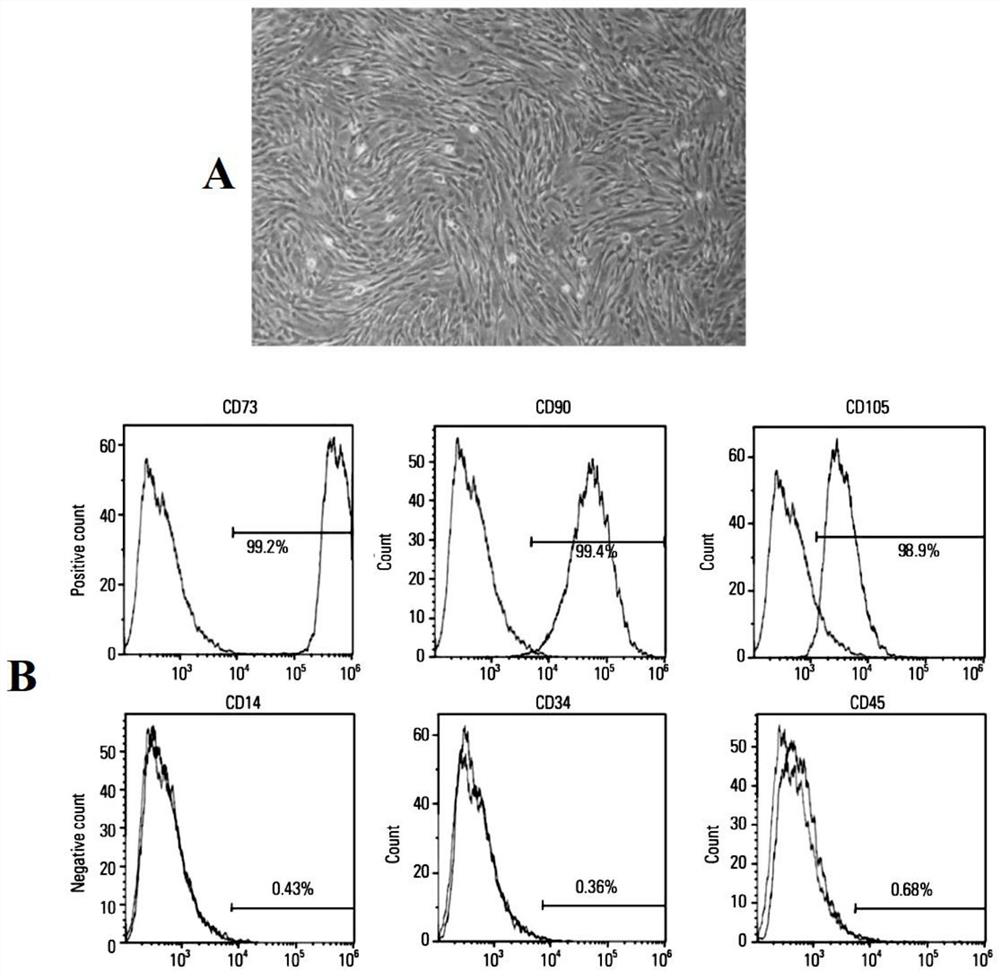 Application of high expression of lncRNA in inhibiting aging of umbilical cord mesenchymal stem cells