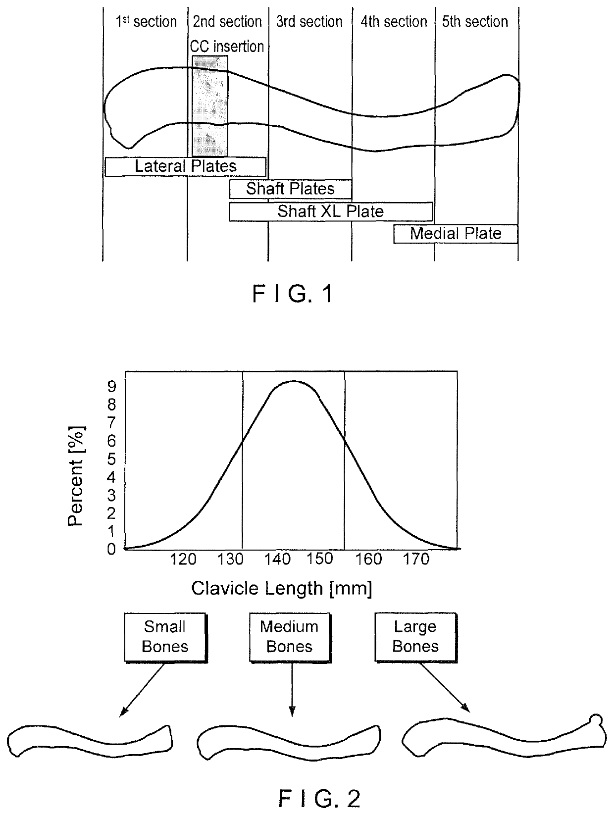 Clavicle segmental plate system