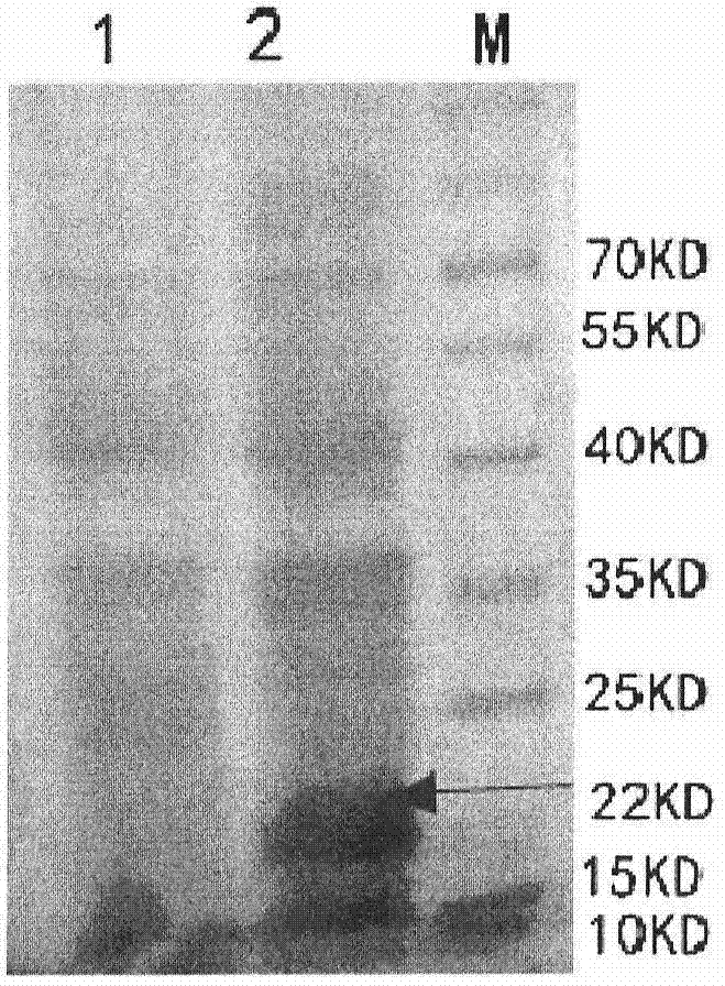 Bacteriophage lysin with improved antibacterial effect