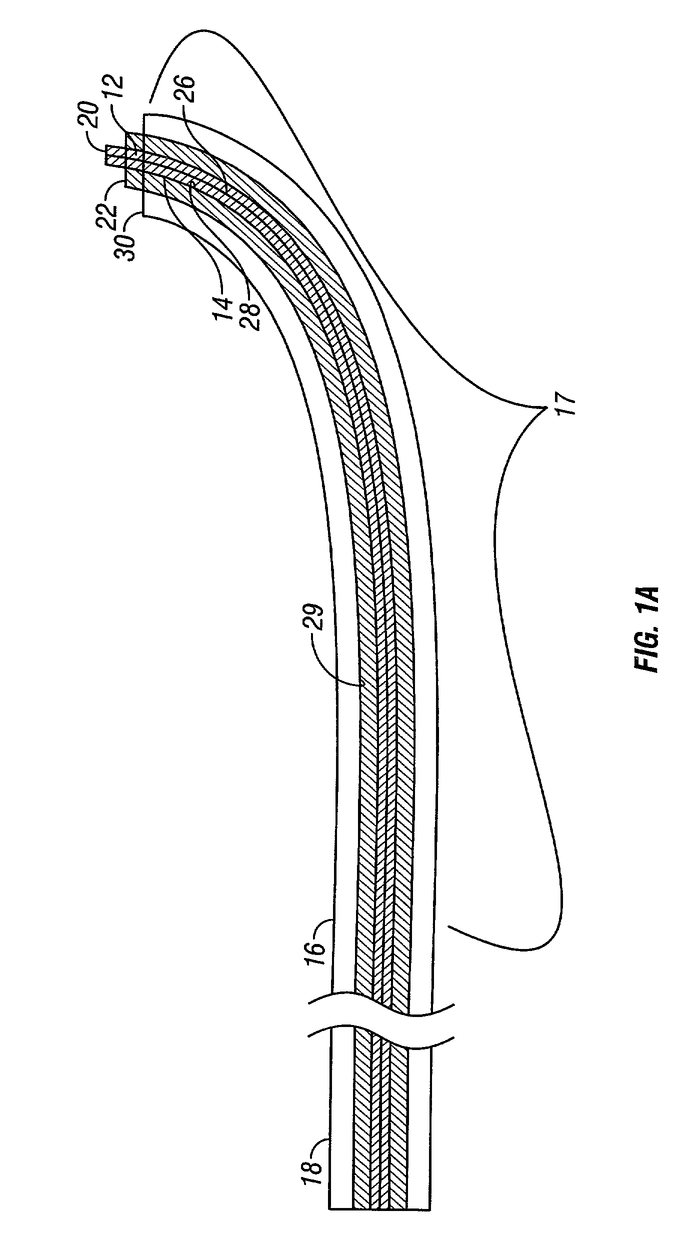 Telescopic introducer with a compound curvature for inducing alignment and method of using the same