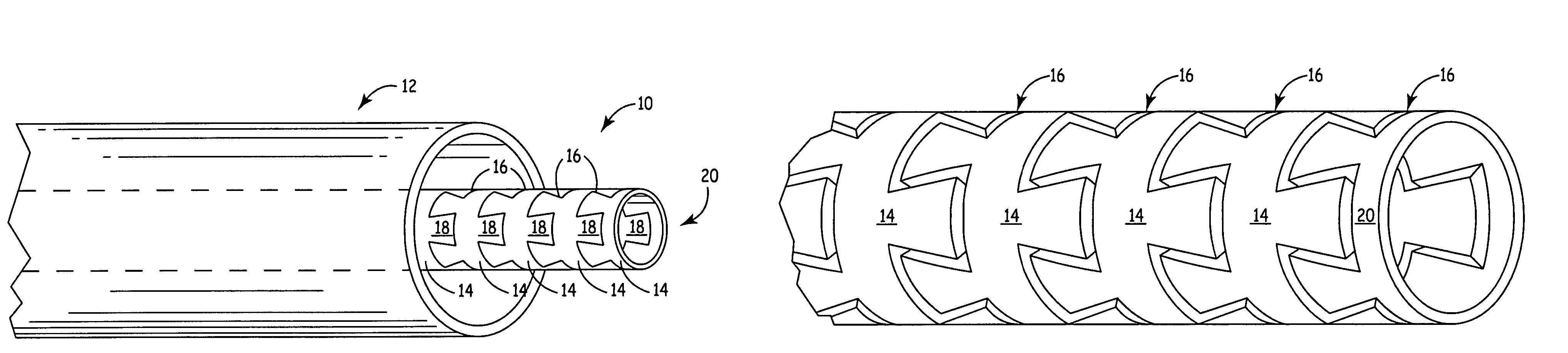 Flexible center connection for occlusion device