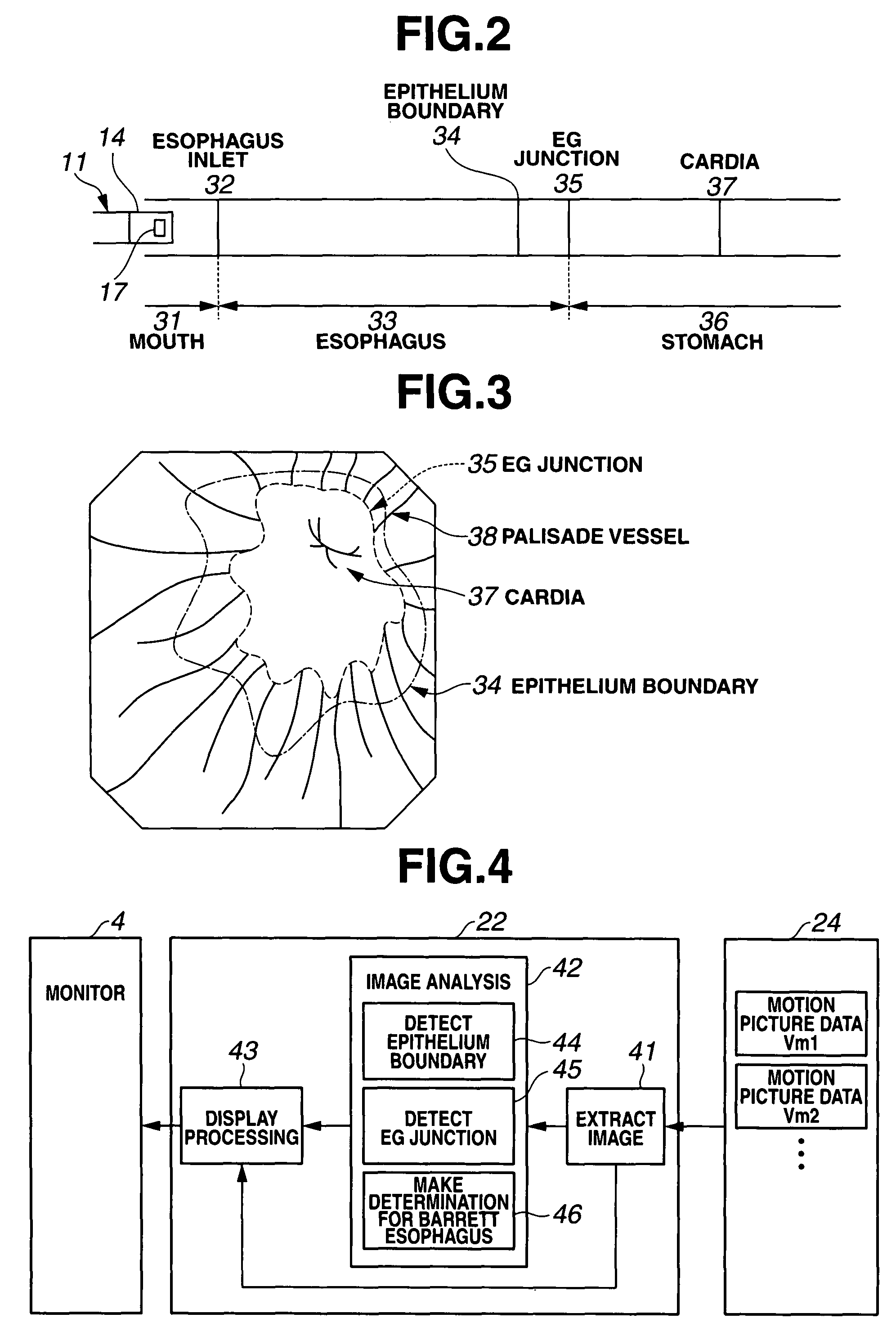 Medical image processing apparatus, luminal image processing apparatus, luminal image processing method, and programs for the same