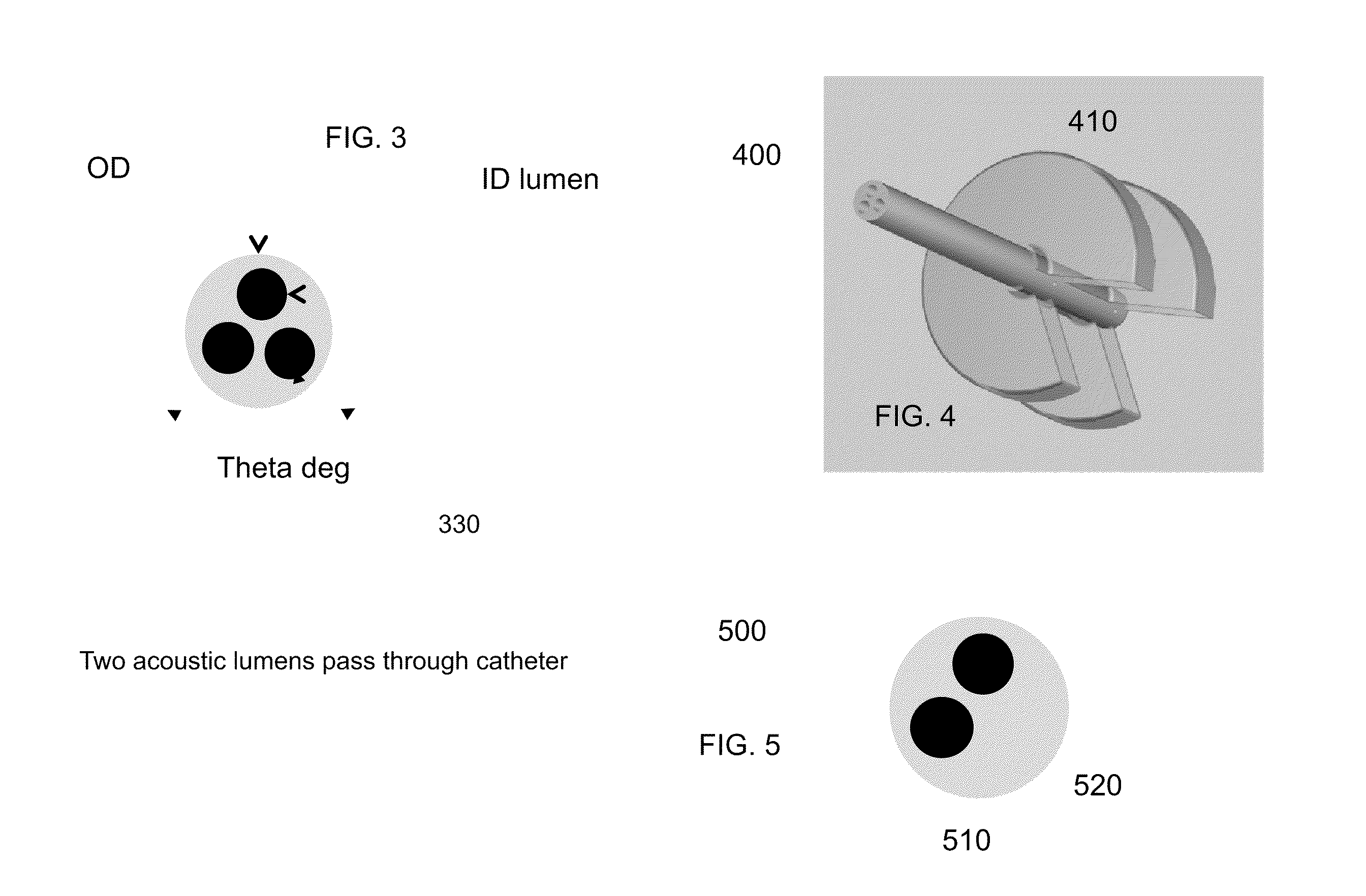 Device and Method to reduce Ear Wax Clogging of Acoustic Ports, Hearing Aid Sealing System, and Feedback Reduction System