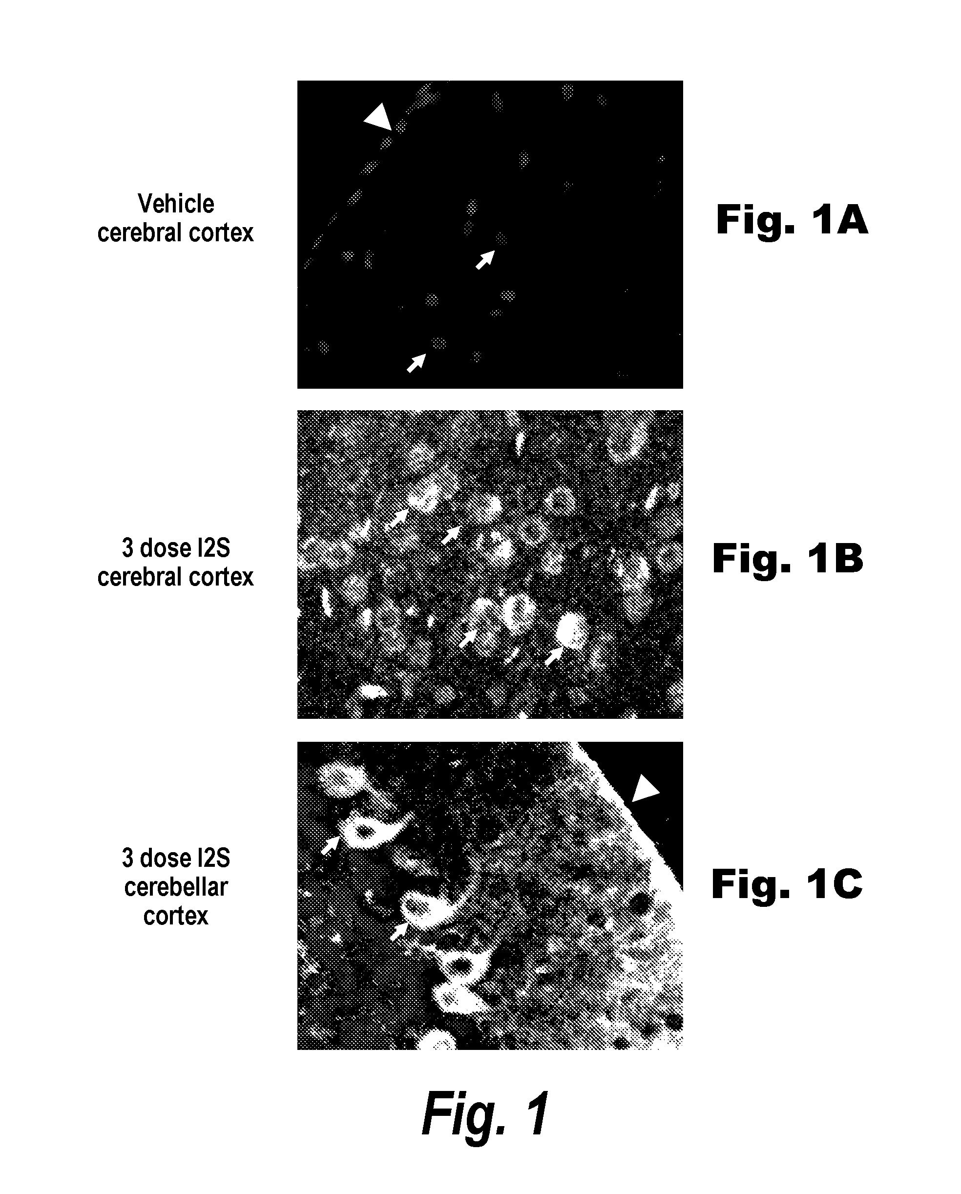 Methods and compositions for CNS delivery of iduronate-2-sulfatase