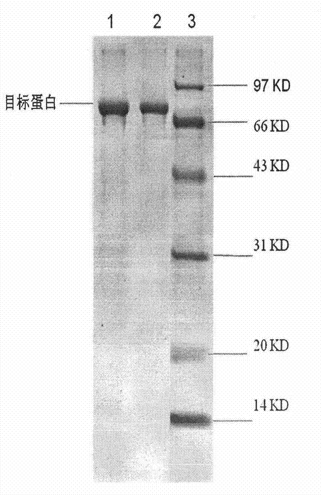 Method for preparing acetylcoenzyme A synthetase in human pathogen clostridium difficile