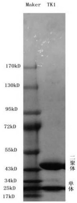 TK1 antibody, kit and application of TK1 antibody