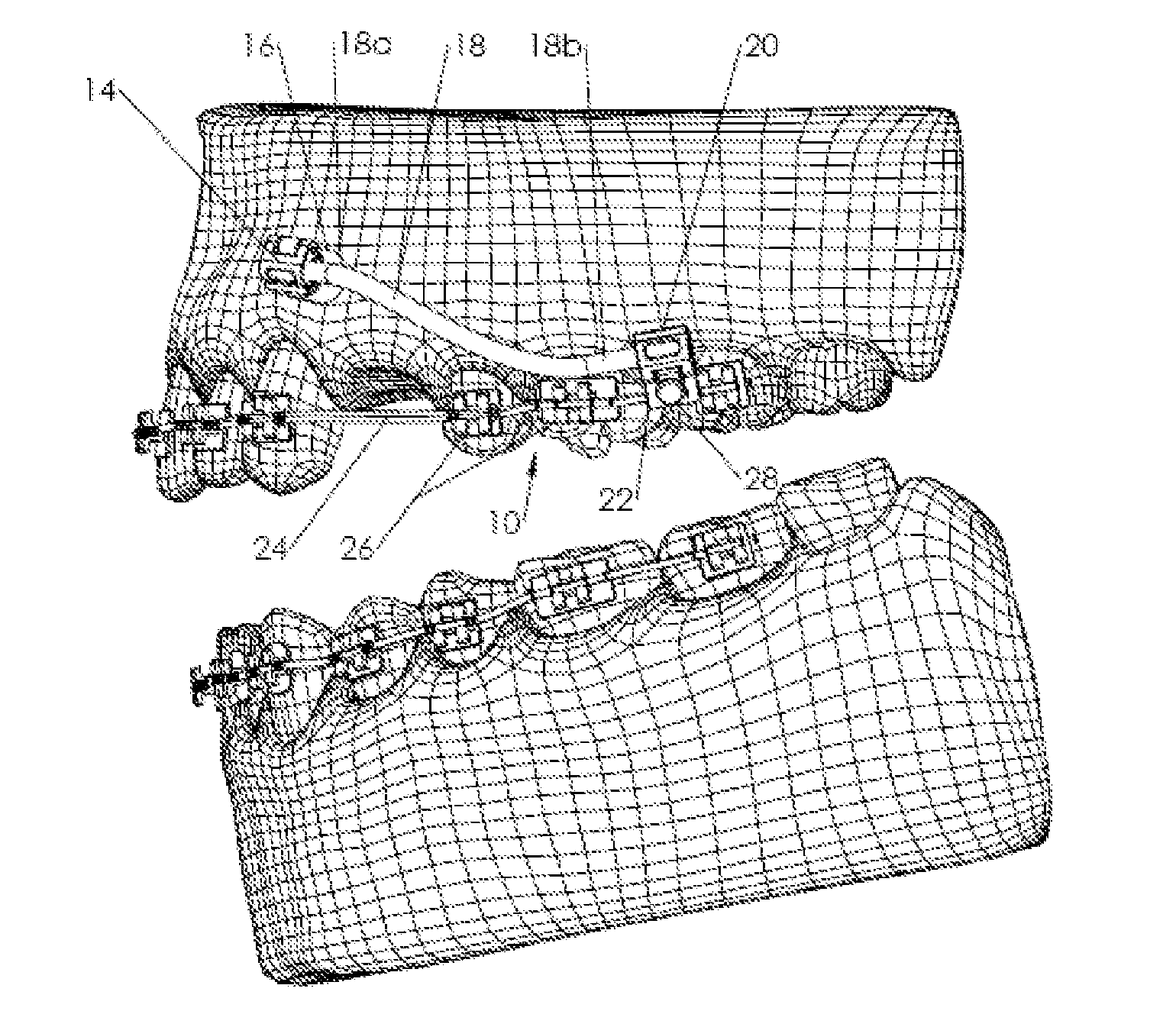 Orthodontic appliance anchoring method and apparatus