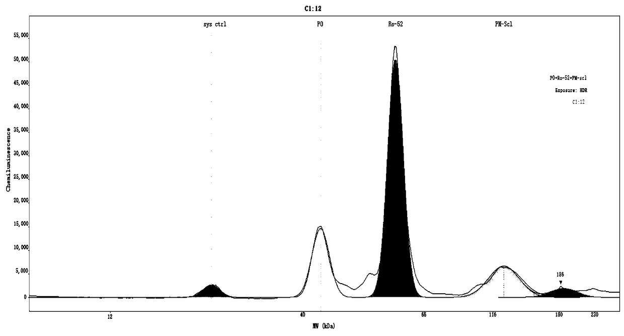 Detection method for rapidly and quantitatively detecting content of antinuclear antibody