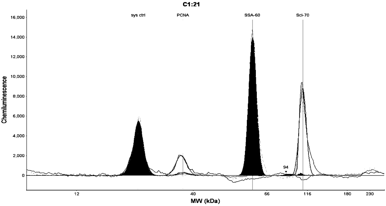 Detection method for rapidly and quantitatively detecting content of antinuclear antibody