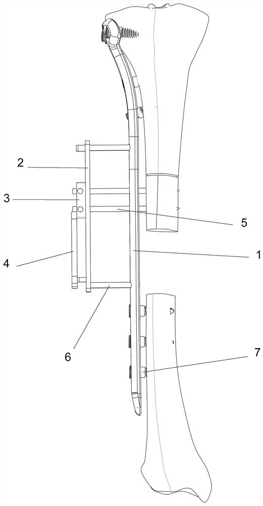 Long bone locking steel plate traction external fixator and using method thereof