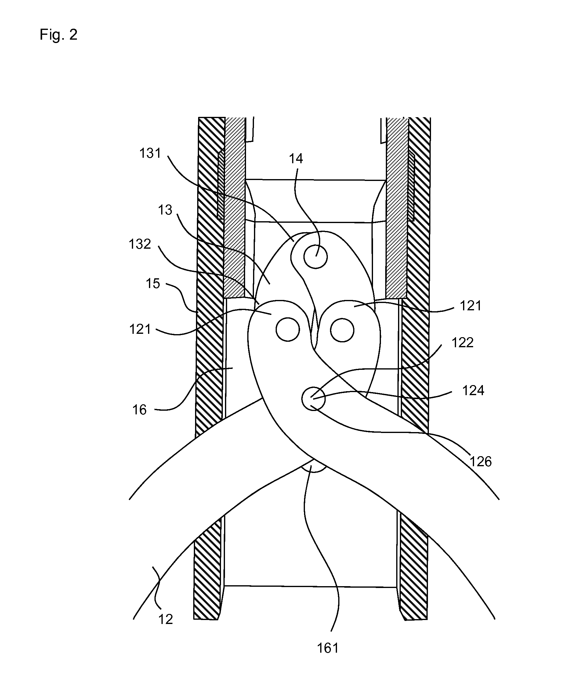 Actuation grip for a microsurgical instrument, and microsurgical instrument