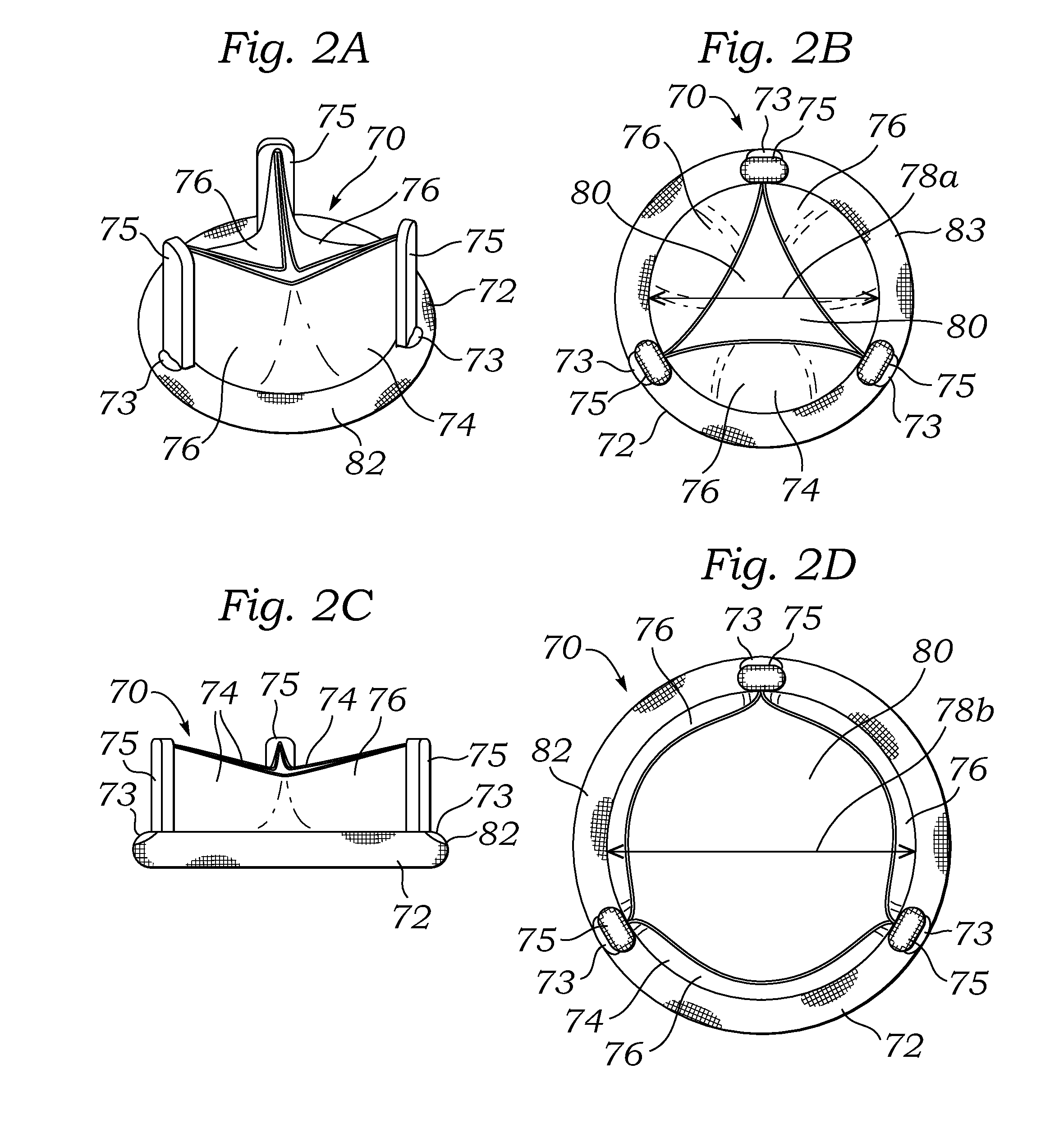 Post-implant expandable surgical heart valve configurations