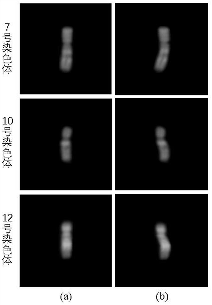 Bent chromosome image straightening method based on joint model