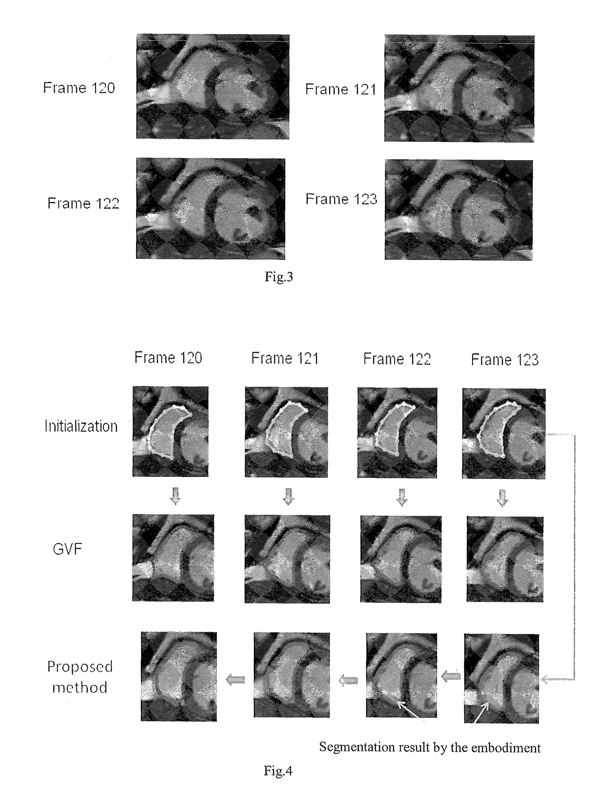 Segmentation of cardiac magnetic resonance (CMR) images using a memory persistence approach