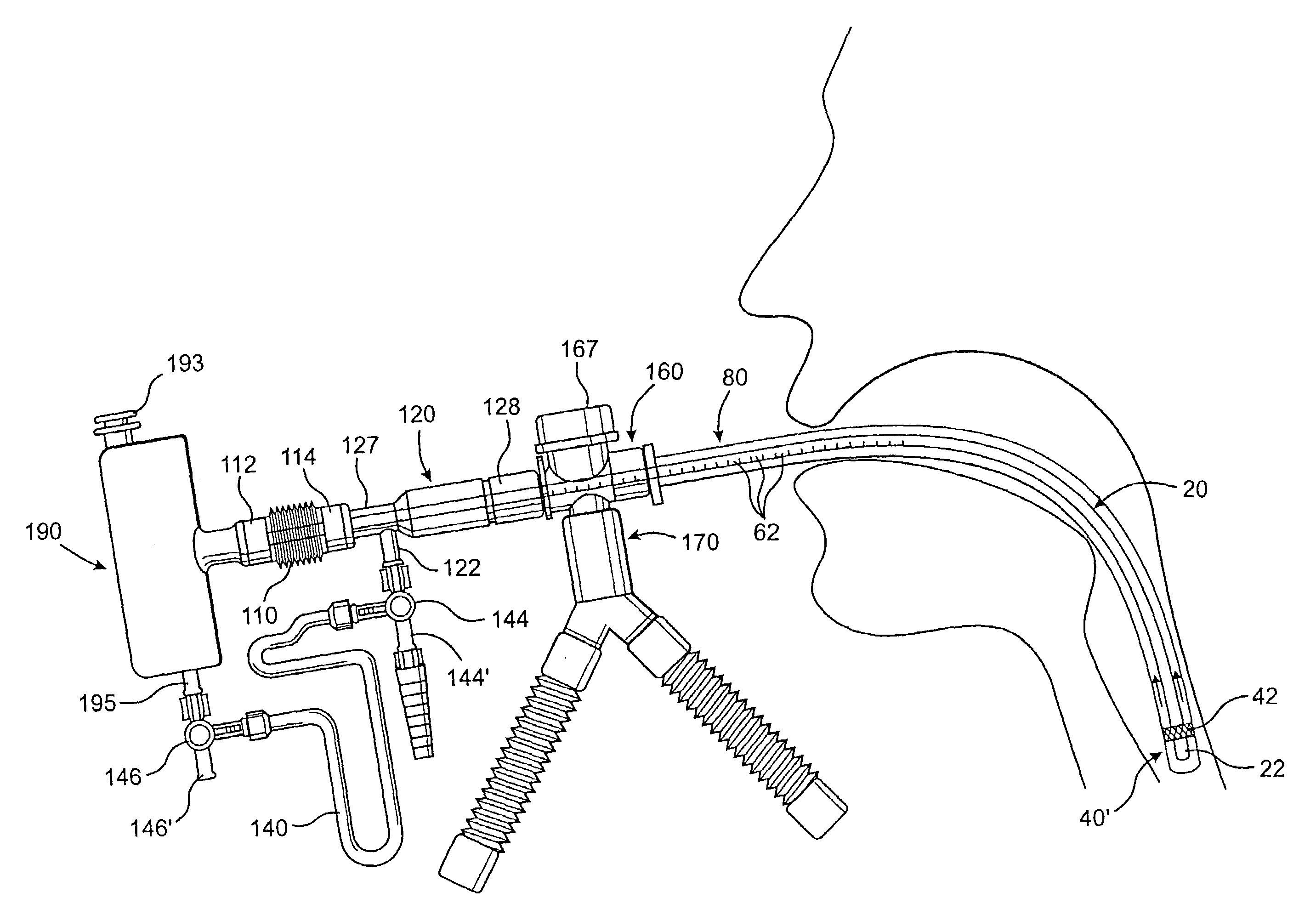 Endotracheal tube cleaning apparatus and method