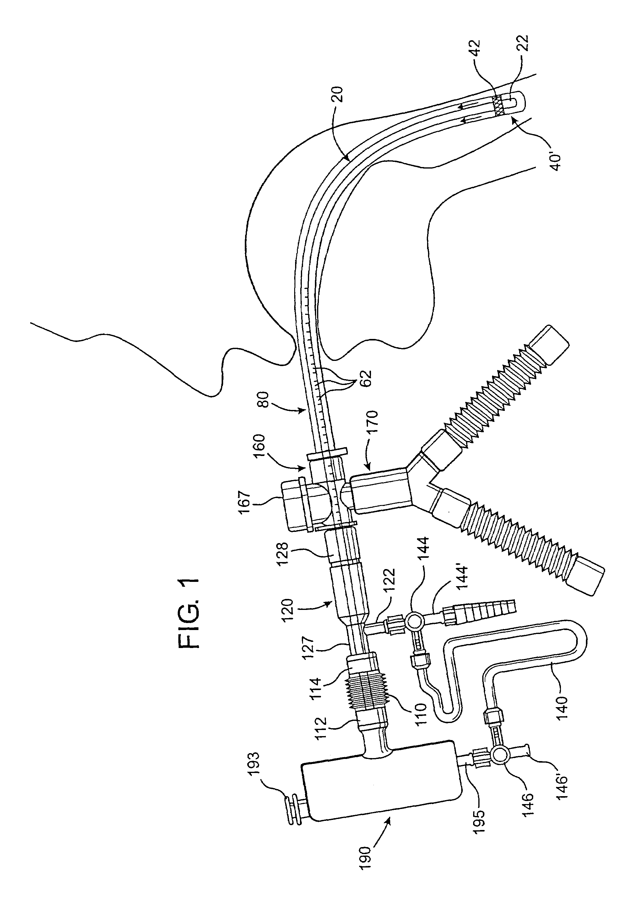 Endotracheal tube cleaning apparatus and method