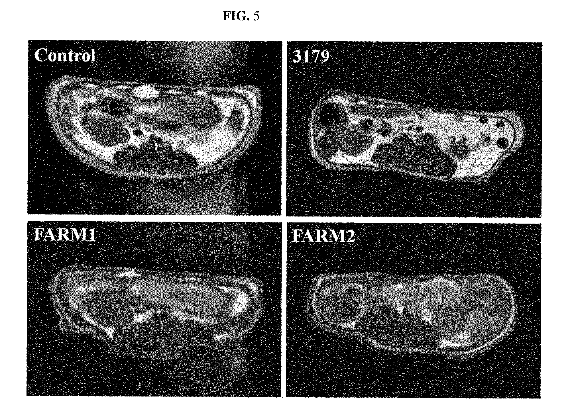 Compositions and methods for prevention and treatment of obesity and obesity related metabolic syndrome