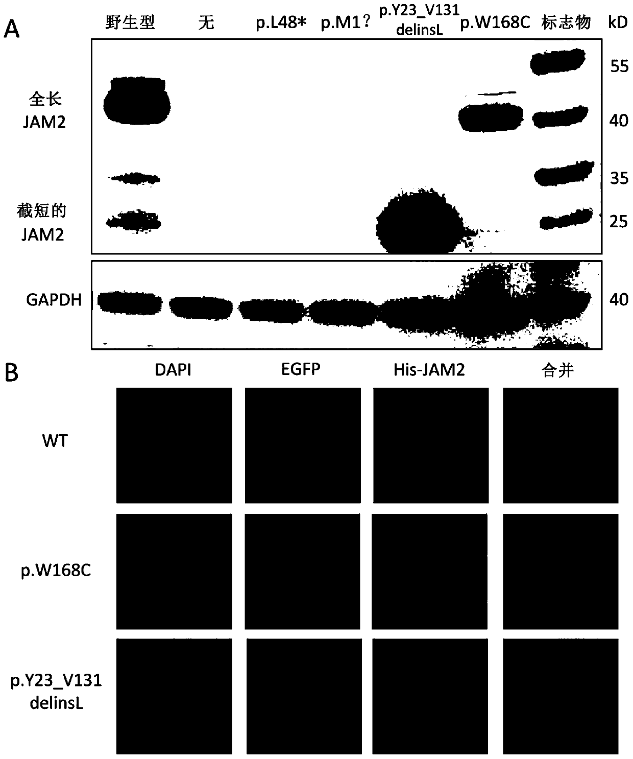 Primary familial brain calcification pathogenic gene JAM2 and application thereof