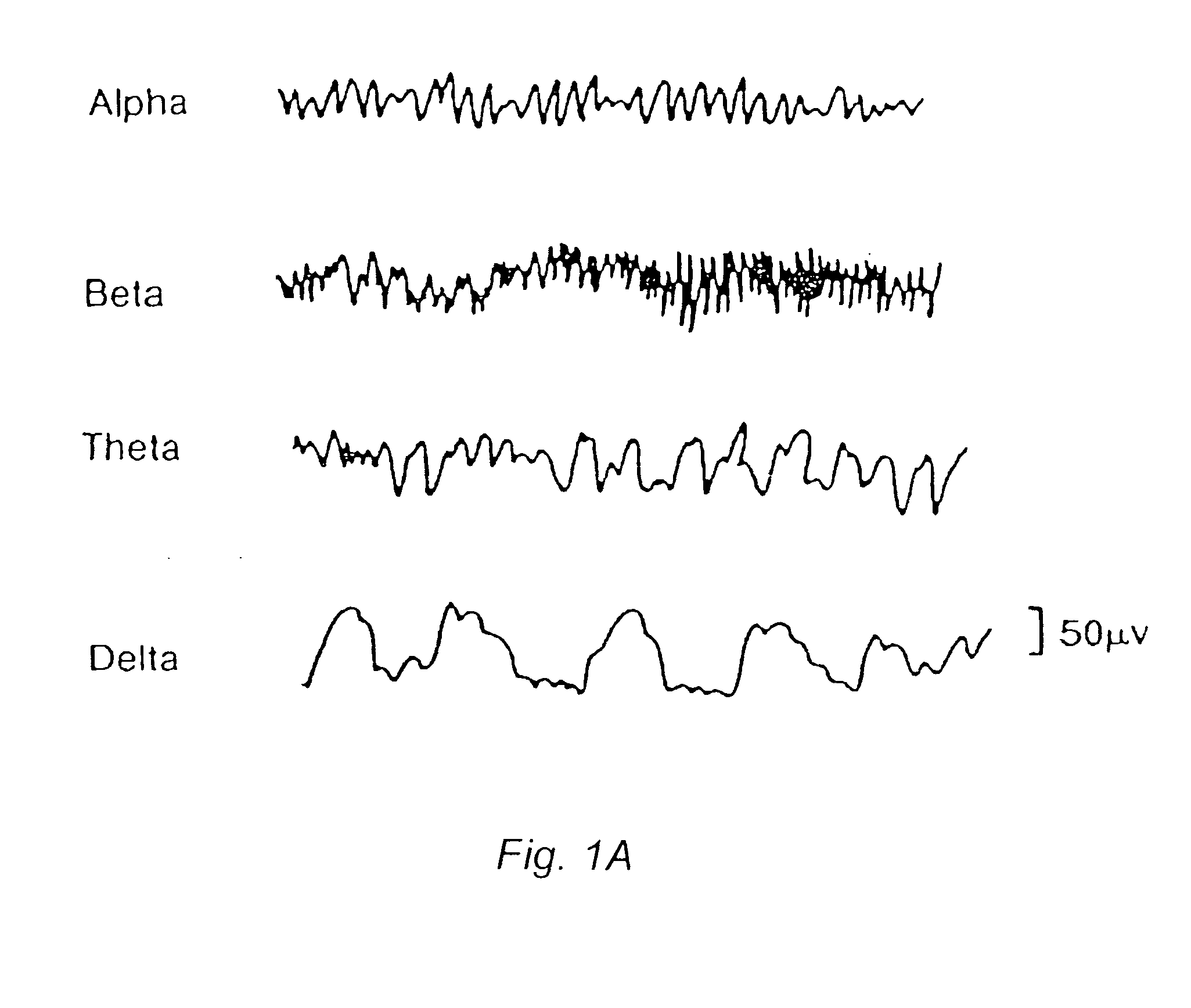 Method and system for analyzing and presenting an Electroencephalogram (EEG)
