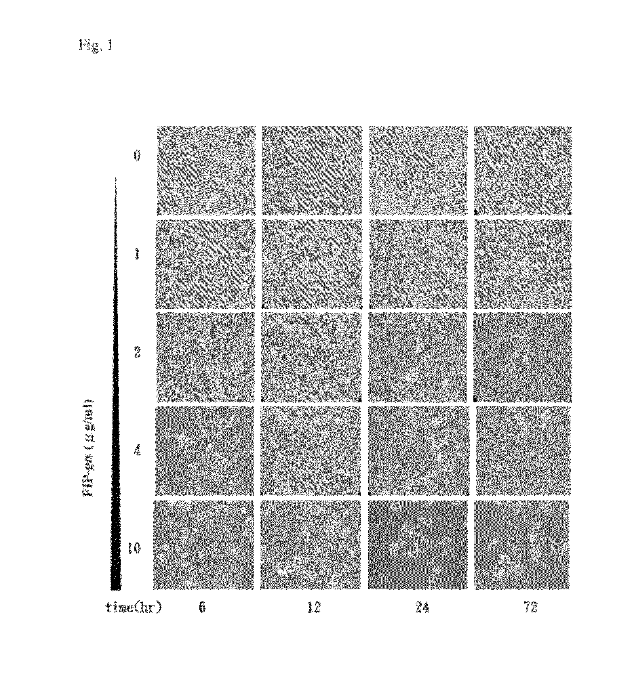 Compositions comprising fungal immunomodulatory protein and use thereof