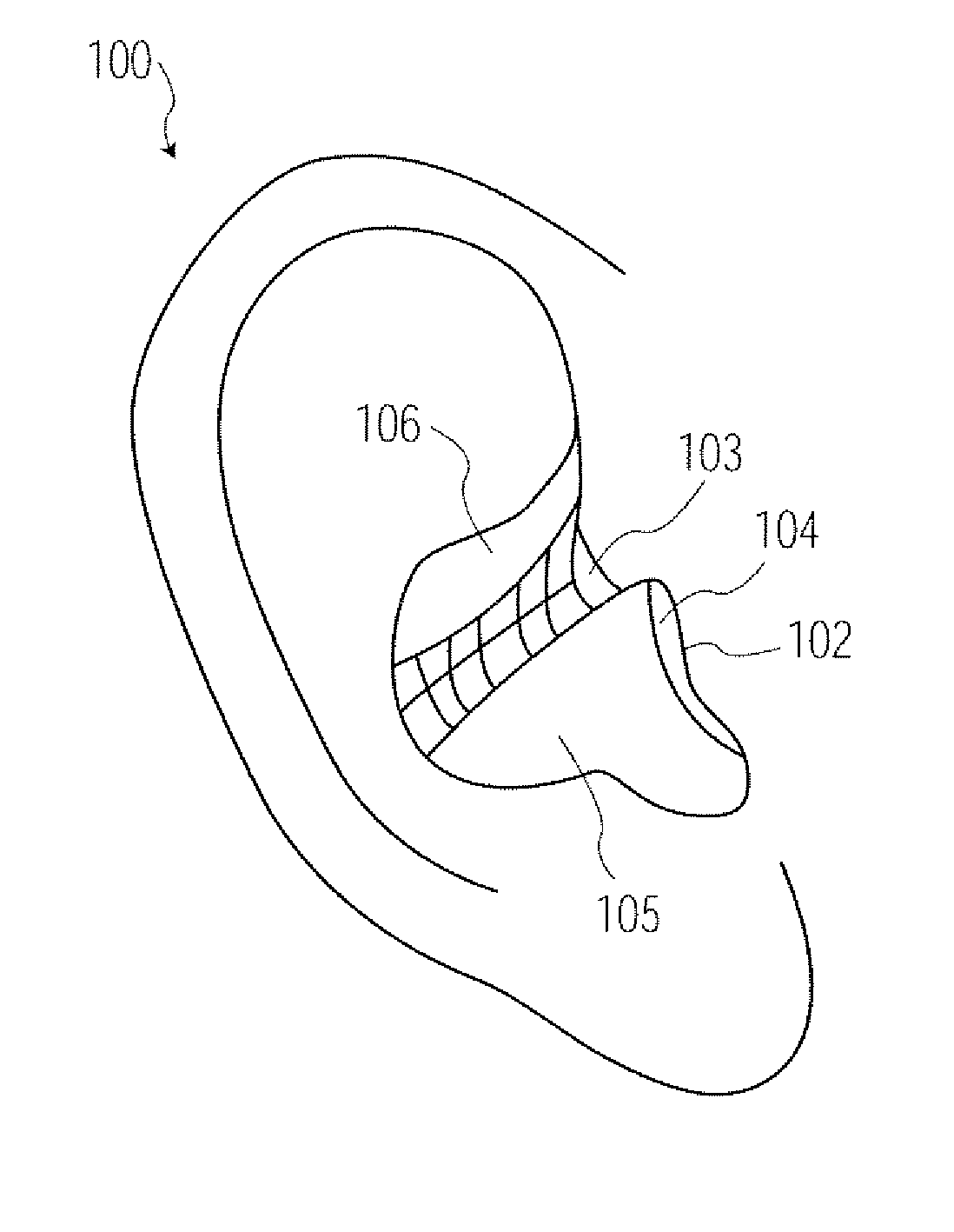 Method and Apparatus for Aperture Detection of 3D Hearing Aid Shells