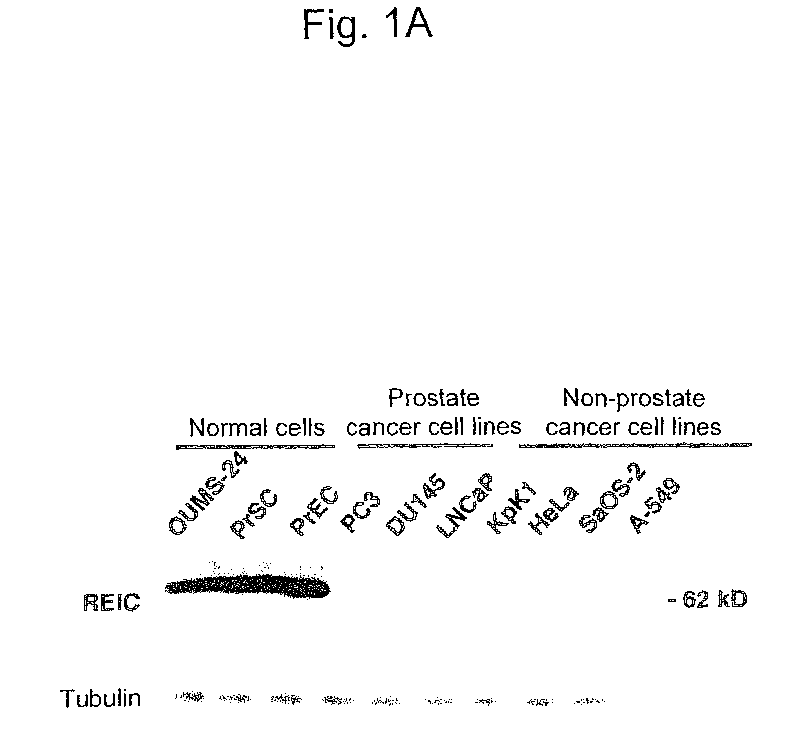 Apoptosis-inducing agent for prostate cancer cells